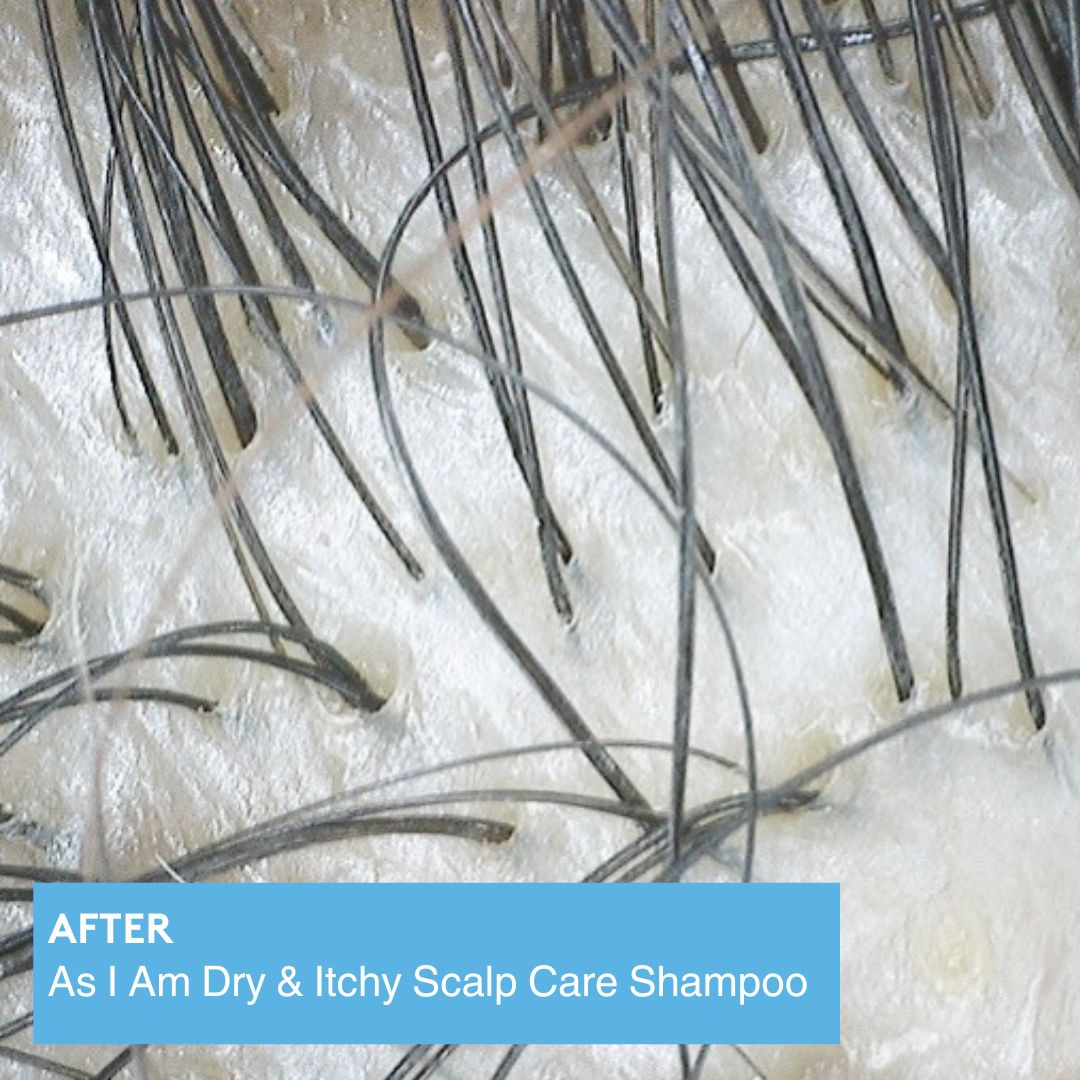 Shampoo zur Pflege trockener & juckender Kopfhaut